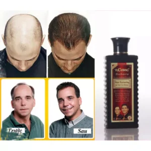 Hair Nurturing Anti Hair Loss Shampoo in Pakistan - Shoppkar.Com